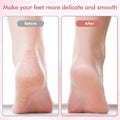 Callus Remover for Feet